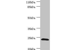 Western blot All lanes: GSTZ1 antibody at 0. (GSTZ1 antibody  (AA 1-216))