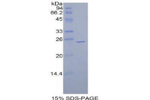 SDS-PAGE (SDS) image for Glutathione Peroxidase 5 (GPX5) (AA 22-221) protein (His tag) (ABIN1878367)