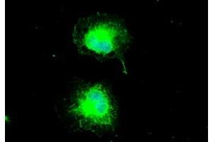 Anti-CTAG1B mouse monoclonal antibody (ABIN2452329) immunofluorescent staining of COS7 cells transiently transfected by pCMV6-ENTRY CTAG1B (RC213318). (CTAG1B antibody)