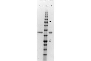 SDS-PAGE results of ERK2 Recombinant Protein. (ERK2 Protein)