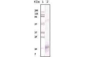 Western Blotting (WB) image for anti-Interferon gamma (IFNG) antibody (ABIN2464066) (Interferon gamma antibody)