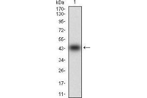 Western blot analysis using MMEL1 mAb against human MMEL1 (AA: 1-107) recombinant protein. (MMEL1 antibody  (AA 1-107))