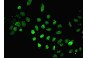 Immunofluorescent analysis of A549 cells using ABIN7150189 at dilution of 1:100 and Alexa Fluor 488-congugated AffiniPure Goat Anti-Rabbit IgG(H+L) (LIG1 antibody  (AA 1-919))