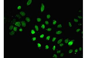Immunofluorescent analysis of A549 cells using ABIN7150189 at dilution of 1:100 and Alexa Fluor 488-congugated AffiniPure Goat Anti-Rabbit IgG(H+L) (LIG1 antibody  (AA 1-919))