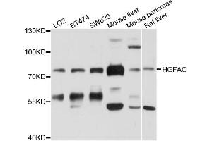 Western blot analysis of extracts of various cell lines, using HGFAC antibody (ABIN6003812) at 1/1000 dilution. (HGFA antibody)