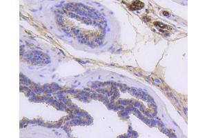 Paraformaldehyde-fixed, paraffin embedded mouse prostate, Antigen retrieval by boiling in sodium citrate buffer (pH6) for 15min, Block endogenous peroxidase by 3% hydrogen peroxide for 30 minutes, Blocking buffer at 37°C for 20min, Antibody incubation with Cytokeratin 14 (2F11) Monoclonal Antibody  at 1:50 overnight at 4°C, followed by a conjugated secondary and DAB staining. (KRT14 antibody)