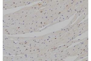 ABIN6258115 and ABIN6274297 at 1/100 staining Mouse heart tissue by IHC-P.