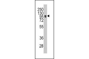 Western blot analysis of anti-CEBPZ Antibody (C-term) (ABIN389193 and ABIN2839356) in NCI- cell line lysates (35 μg/lane).