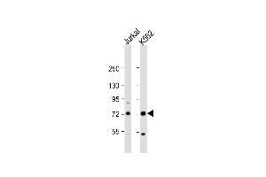 All lanes : Anti-PRMT5 Antibody (N-term) at 1:1000 dilution Lane 1: Jurkat whole cell lysate Lane 2: K562 whole cell lysate Lysates/proteins at 20 μg per lane. (PRMT5 antibody  (N-Term))