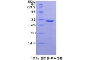 SDS-PAGE (SDS) image for STAM Binding Protein (STAMBP) (AA 166-406) protein (His tag) (ABIN2126852)