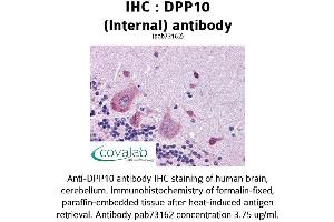 Image no. 1 for anti-Dipeptidylpeptidase 10 (DPP10) (Internal Region) antibody (ABIN1733745) (DPP10 antibody  (Internal Region))