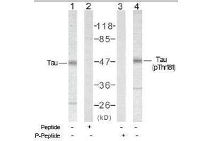 Image no. 1 for anti-Microtubule-Associated Protein tau (MAPT) (Thr181) antibody (ABIN197262) (MAPT antibody  (Thr181))