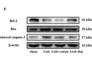 The effects of Bak on cellular apoptosis and neuronal degeneration following SAH. (beta Actin antibody  (AA 1-375))