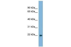 LBX2 antibody used at 0. (LBX2 antibody  (Middle Region))