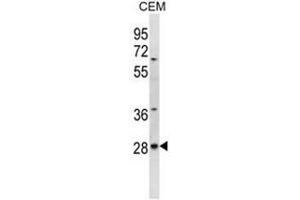 ALKBH4 Antibody (Center) western blot analysis in CEM cell line lysates (35µg/lane). (ALKBH4 antibody  (Middle Region))