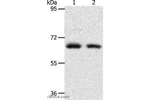 Western blot analysis of Human fetal kidney and fetal lung tissue, using ACOT11 Polyclonal Antibody at dilution of 1:450 (ACOT11 antibody)
