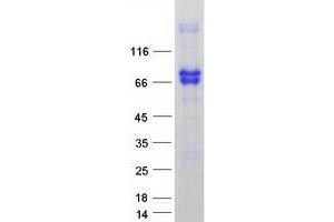 Western Blotting (WB) image for Nerve Growth Factor Receptor (NGFR) protein (Myc-DYKDDDDK Tag) (ABIN2713579)