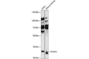 Western blot analysis of extracts of various cell lines, using KCNK3 antibody (ABIN7269470) at 1:1000 dilution. (KCNK3 antibody  (AA 250-394))