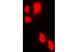 Immunofluorescent analysis of JAK2 staining in Jurkat cells. (JAK2 antibody)