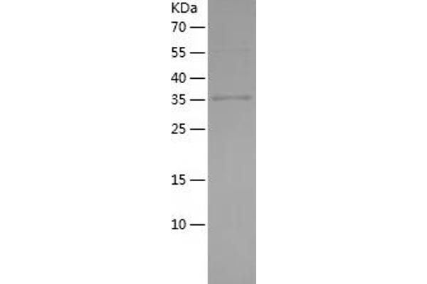 Macrophage Mannose Receptor 1 Protein (AA 19-148) (His-IF2DI Tag)
