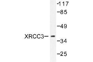 Image no. 2 for anti-X-Ray Repair Complementing Defective Repair in Chinese Hamster Cells 3 (XRCC3) antibody (ABIN271981) (XRCC3 antibody)