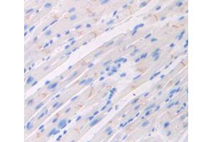 Used in DAB staining on fromalin fixed paraffin- embedded heart tissue (FLRT2 antibody  (AA 300-517))