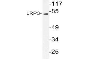 Western blot (WB) analysis of LRP3 antibody in extracts from RAW264.