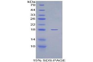 SDS-PAGE of Protein Standard from the Kit (Highly purified E. (IL-6 Receptor ELISA Kit)