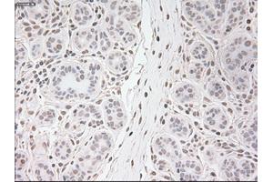 Immunohistochemical staining of paraffin-embedded breast tissue using anti-USP13 mouse monoclonal antibody.