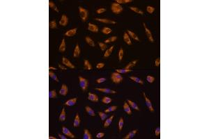 Immunofluorescence analysis of L929 cells using GLP1R antibody (ABIN6131006, ABIN6141138, ABIN6141140 and ABIN6224643) at dilution of 1:100. (GLP1R antibody  (AA 22-116))