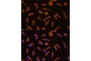 Immunofluorescence analysis of L929 cells using GLP1R antibody (ABIN6131006, ABIN6141138, ABIN6141140 and ABIN6224643) at dilution of 1:100. (GLP1R antibody  (AA 22-116))