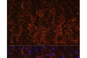 Immunofluorescence analysis of Mouse brain using SNX13 Polyclonal Antibody at dilution of 1:100. (SNX13 antibody)