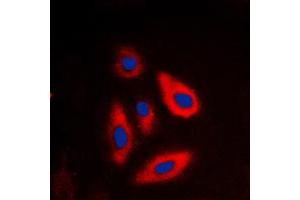 Immunofluorescent analysis of Galactose Kinase staining in HepG2 cells. (GALK1 antibody  (N-Term))