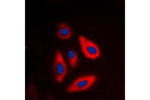 Immunofluorescent analysis of Galactose Kinase staining in HepG2 cells.
