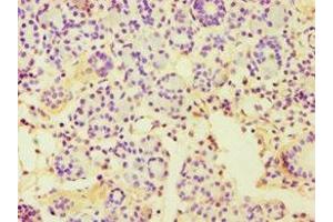Immunohistochemistry of paraffin-embedded human pancreatic tissue using ABIN7150999 at dilution of 1:100 (CBLC antibody  (AA 245-474))