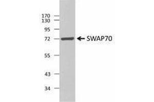 Western Blotting (WB) image for anti-SWAP Switching B-Cell Complex 70kDa Subunit (SWAP70) antibody (ABIN2666297) (SWAP70 antibody)