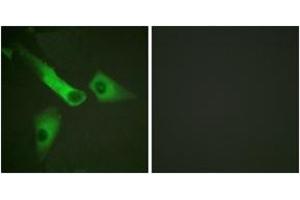 Immunofluorescence analysis of HeLa cells, using Caspase 9 (Ab-153) Antibody. (Caspase 9 antibody  (AA 119-168))