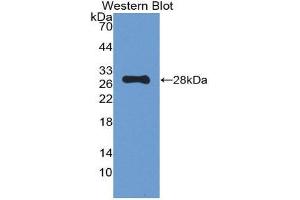 Western Blotting (WB) image for anti-Proopiomelanocortin (POMC) (AA 27-235) antibody (ABIN1077682) (POMC antibody  (AA 27-235))