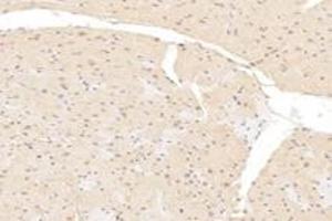 Immunohistochemistry analysis of paraffin-embedded mouse heart using,MCC-2 (ABIN7076163) at dilution of 1: 6000 (USHBP1 antibody)