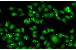 Immunofluorescence analysis of MCF7 cells using NR2C1 Polyclonal Antibody (NR2C1 antibody)