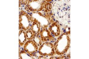 Immunohistochemistry (Paraffin-embedded Sections) (IHC (p)) image for anti-F-Box and Leucine-Rich Repeat Protein 17 (FBXL17) (AA 262-297), (C-Term), (Isoform 2) antibody (ABIN1944744)