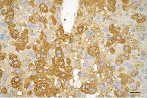 Immunohistochemistry was performed on paraffin-embedded mouse liver using AGL antibody (ABIN7797592), 1:200).