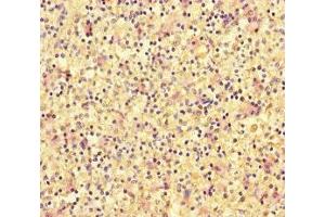 Immunohistochemistry of paraffin-embedded human spleen tissue using ABIN7150566 at dilution of 1:100 (DOK2 antibody  (AA 123-412))