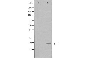 Western blot analysis of extracts of mouse kidney tissue , using REG3G antibody. (REG3g antibody)