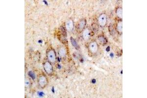 Immunohistochemical analysis of IGF2BP3 staining in mouse brain formalin fixed paraffin embedded tissue section. (IGF2BP3 antibody)