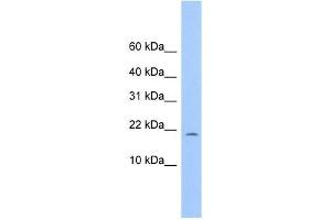 C10ORF83 antibody used at 1 ug/ml to detect target protein. (MORN4 antibody  (Middle Region))