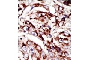 Image no. 1 for anti-Palmitoyl-Protein Thioesterase 1 (PPT1) (C-Term) antibody (ABIN357784) (PPT1 antibody  (C-Term))