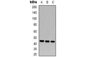 Western blot analysis of MKK2 expression in Hela (A), NIH3T3 (B), rat brain (C) whole cell lysates. (MEK2 antibody)