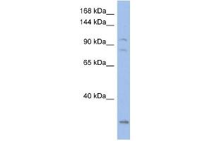 WB Suggested Anti-KCNQ5 Antibody Titration:  0. (KCNQ5 antibody  (Middle Region))