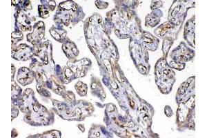 IHC analysis of VEGF Receptor 3 using anti-VEGF Receptor 3 antibody . (FLT4 antibody)